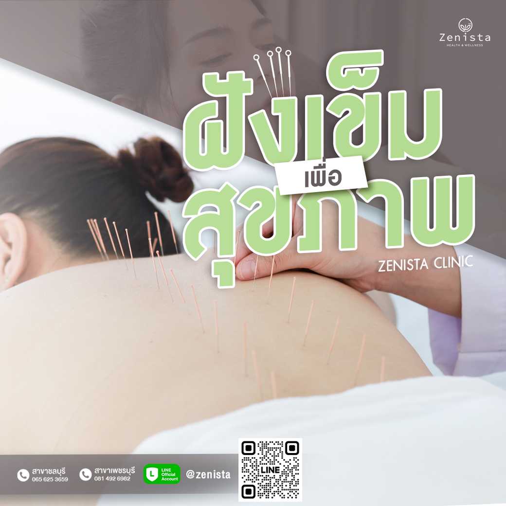 ฝังเข็ม ชลบุรี เพชรบุรี